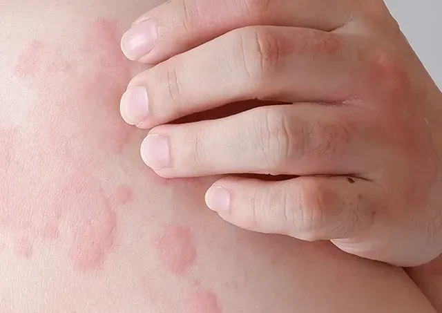 2607504 e1752453256356